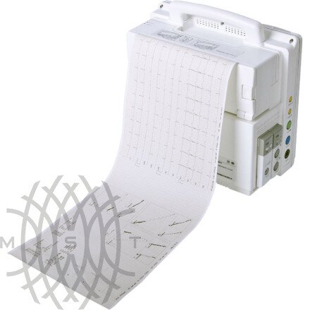 COMEN WQ-004 монитор пациента прикроватный