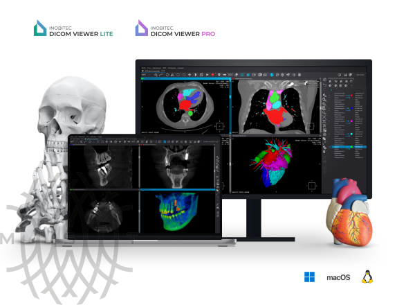 DICOM-просмотрщик Inobitec