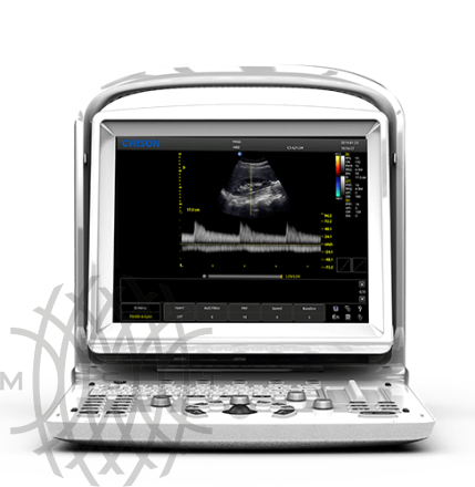 УЗИ аппарат Chison ECO 3 Expert 