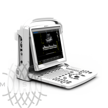 УЗИ аппарат Chison ECO 3 Expert 